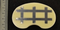 Knee Implantable Sensor