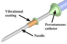 Catheter.tif